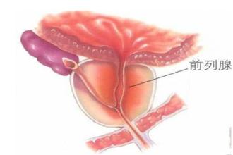 前列腺疾病