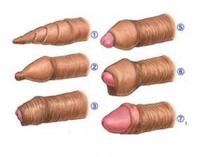 ��Ƥ��������