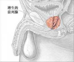 ǰ��������