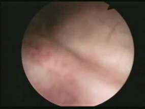 ���׾����