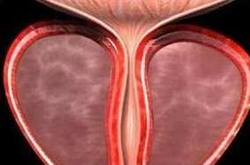 ǰ��������