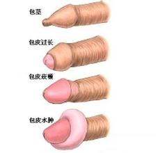 ��Ƥ��������