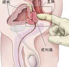 ǰ��������