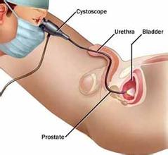 ǰ��������