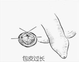 ��Ƥ����