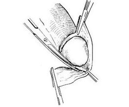 ��Ƥ����