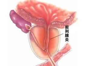 ǰ������