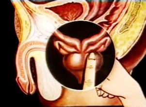 ǰ������