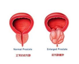 ǰ��������