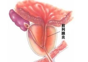 ǰ������