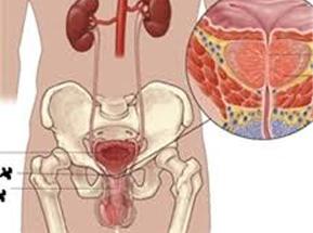 ǰ��������