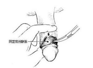 ����Ƥ����