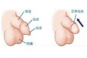 ��Ƥ��������