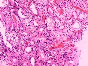 ǰ��������