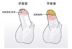 ��Ƥ����