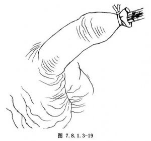 ��Ƥ����