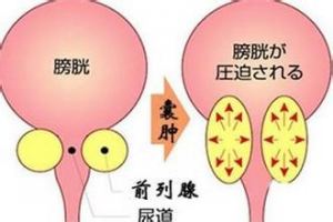 ǰ��������