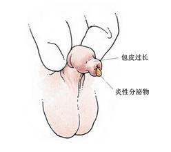 ��ͷ������