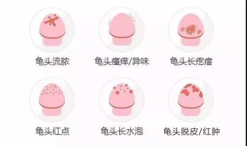 ��ͷ�׵�֢״��������Щ