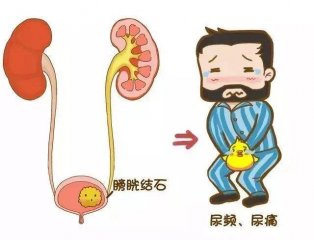 �����׵�֢״��������Щ